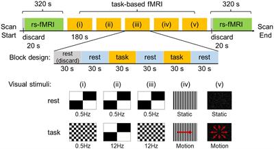 Changes in functional connectivity among vestibulo-visuo-somatosensory and spatial cognitive cortical areas in persistent postural-perceptual dizziness: resting-state fMRI studies before and after visual stimulation